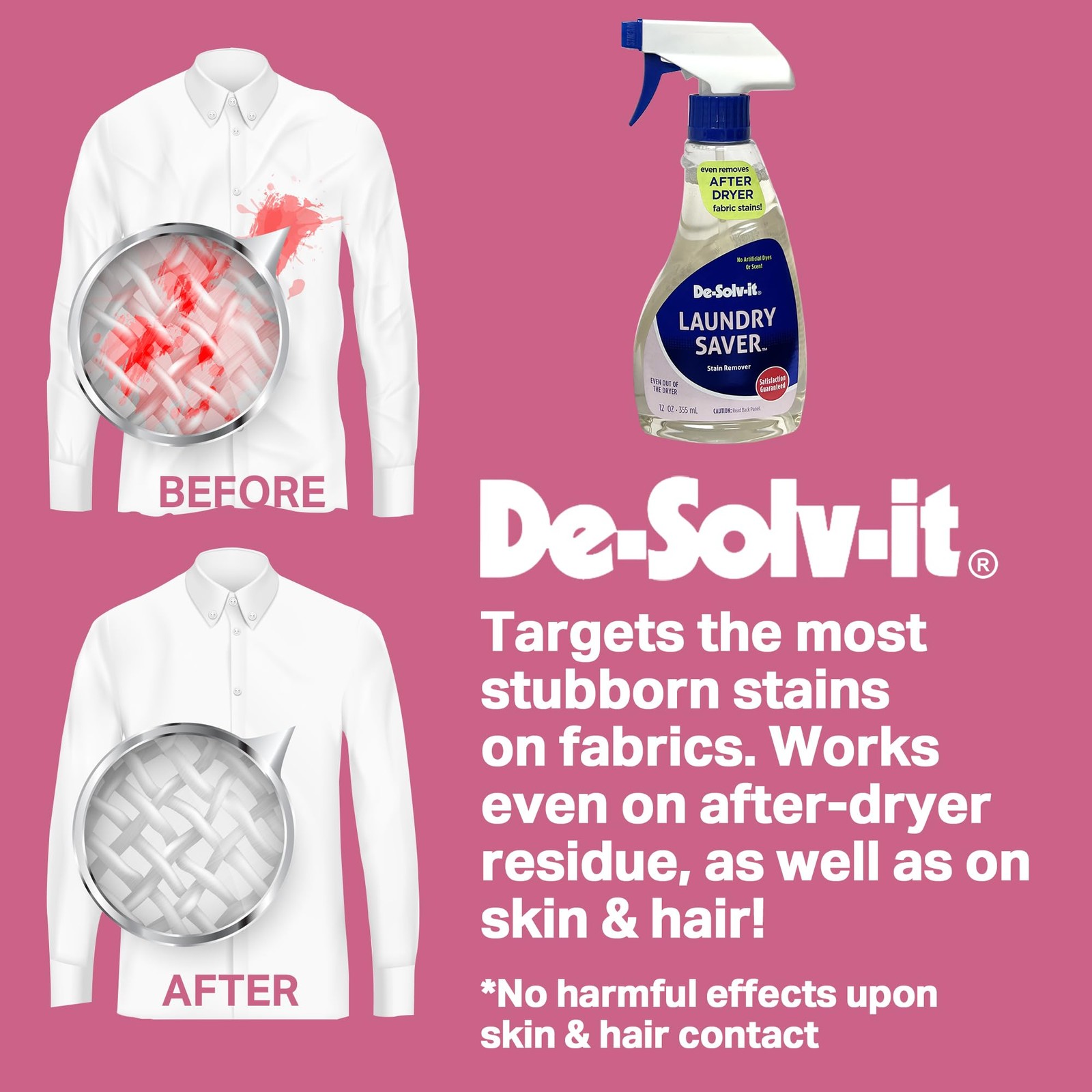 Orange-Sol Laundry Saver, Instant Stain Remover for Laundry, Hair and Skin-Sa…
